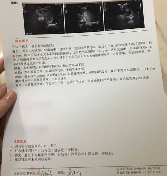 爸爸的胰腺癌