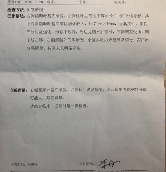 乳腺癌脑转移